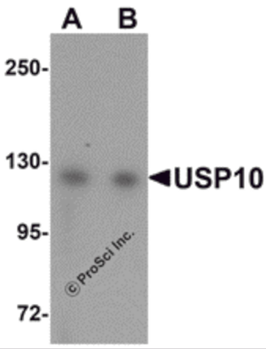 Western blot analysis of USP10 in Jurkat cell lysate with USP10 antibody at (A) 1 and (B) 2 μg/mL.