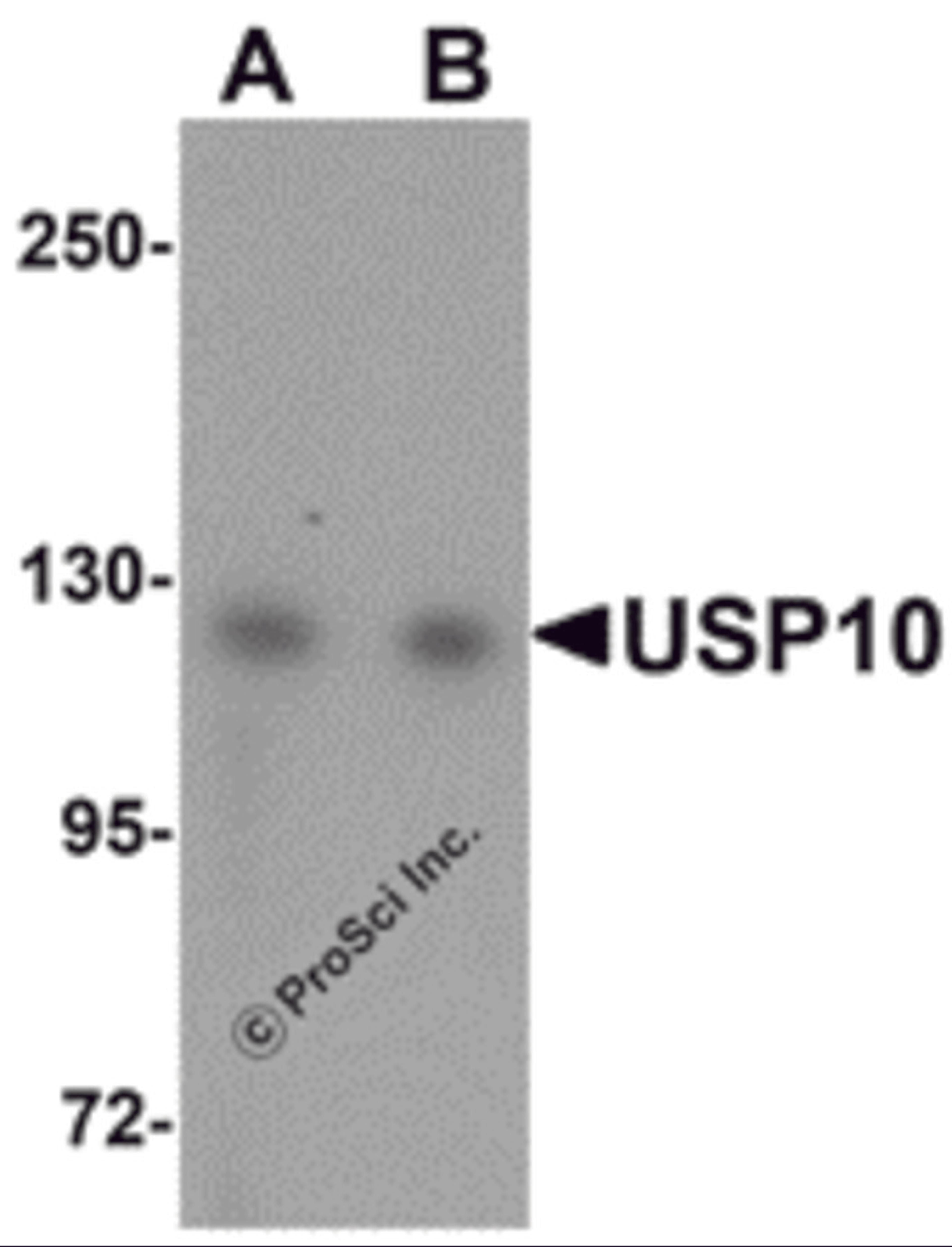 Western blot analysis of USP10 in Jurkat cell lysate with USP10 antibody at (A) 1 and (B) 2 μg/mL.