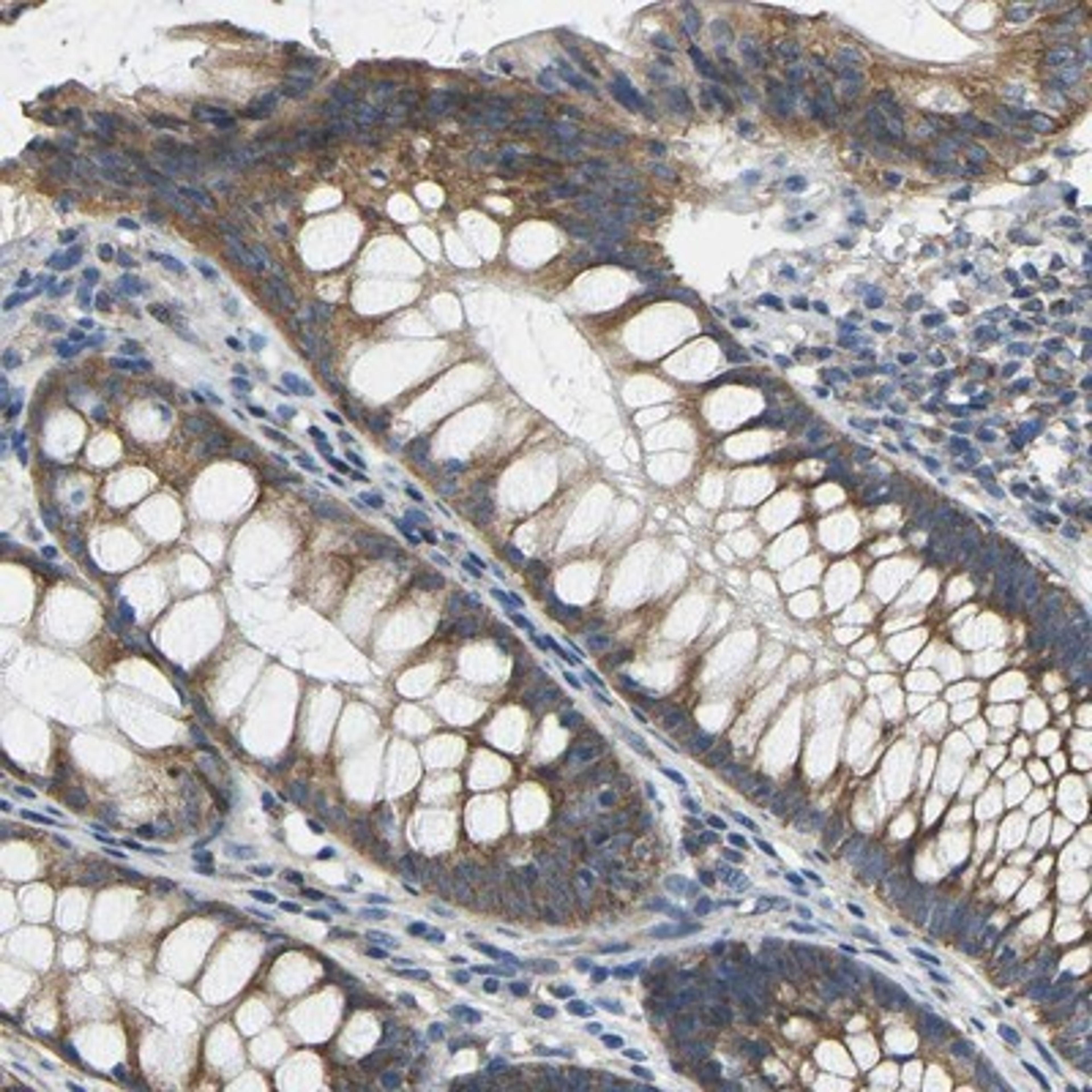 Immunohistochemistry-Paraffin: AHNAK Antibody [NBP1-81059] - Staining of human rectum shows cytoplasmic positivity in glandular cells.