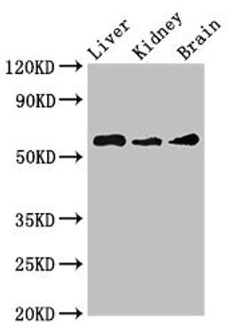Western Blot. Positive WB detected in: Mouse liver tissue, Mouse kidney tissue, Mouse brain tissue. All lanes: CHRM5 antibody at 3.5ug/ml. Secondary. Goat polyclonal to rabbit IgG at 1/50000 dilution. Predicted band size: 61 kDa. Observed band size: 61 kDa.