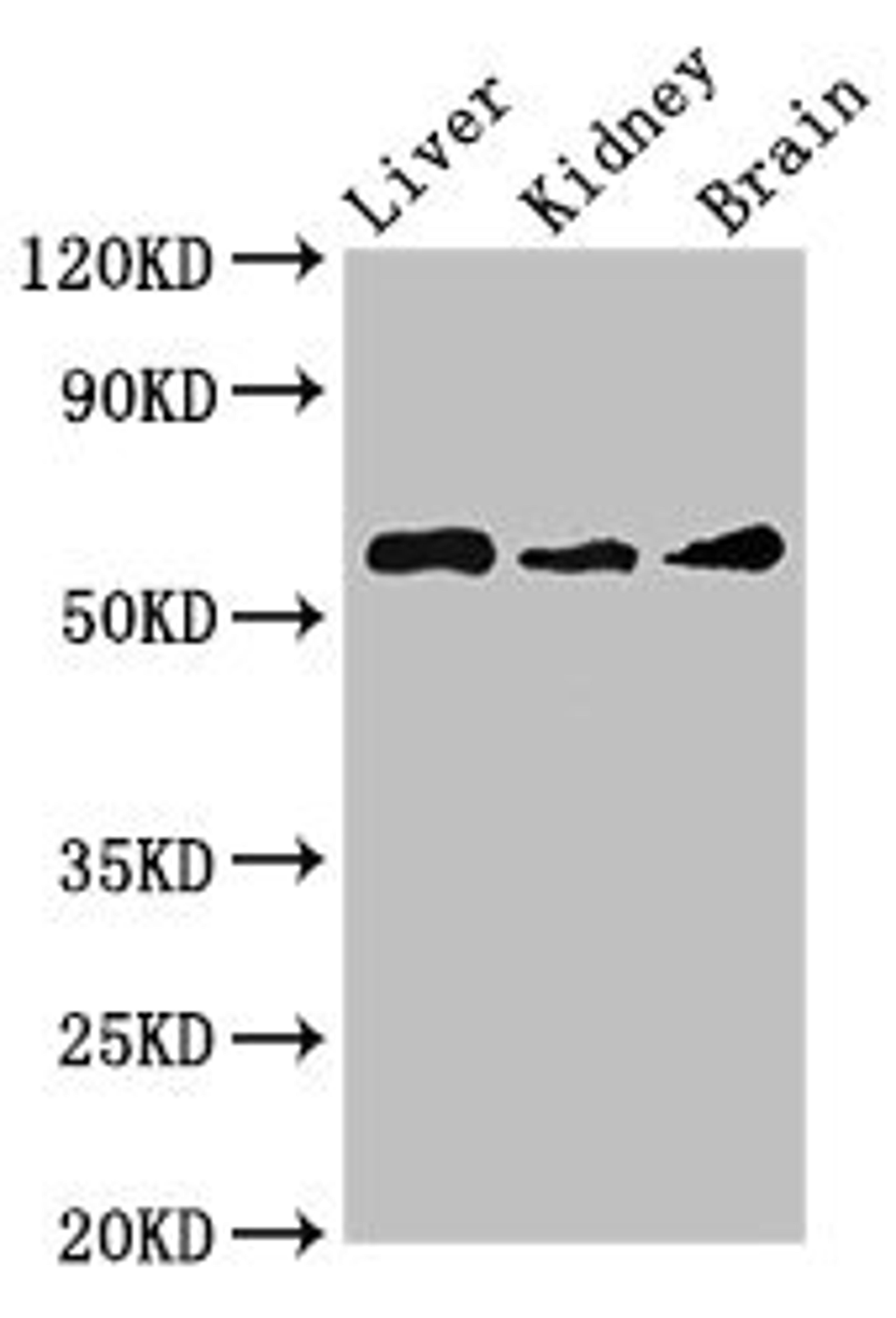Western Blot. Positive WB detected in: Mouse liver tissue, Mouse kidney tissue, Mouse brain tissue. All lanes: CHRM5 antibody at 3.5ug/ml. Secondary. Goat polyclonal to rabbit IgG at 1/50000 dilution. Predicted band size: 61 kDa. Observed band size: 61 kDa.