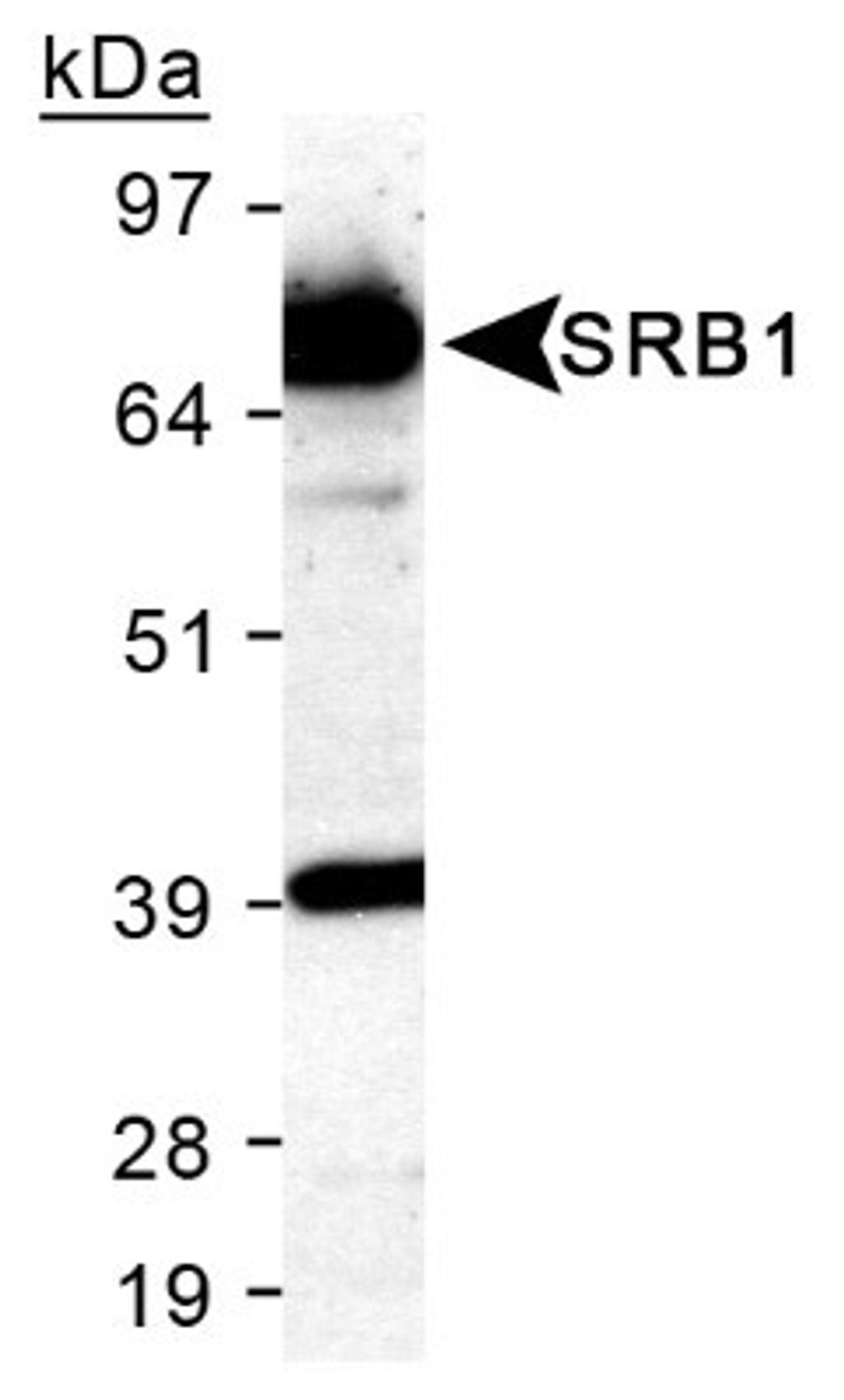 Western Blot: SR-BI Antibody [NB400-104] - Analysis using the HRP conjugate of NB400-104. Detection of SR-BI in 25 ug of mouse liver lysate, using NB400-104 (lotJ) at a 1:1,000 dilution, shows distinct band at 82 kDa.