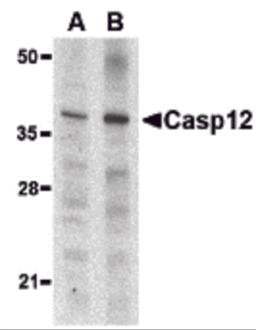 Western blot analysis of caspase-12 in mouse (lane A) and rat (lane B) liver lysate with caspase-12 antibody (small) at 1 &#956;g/mL. 