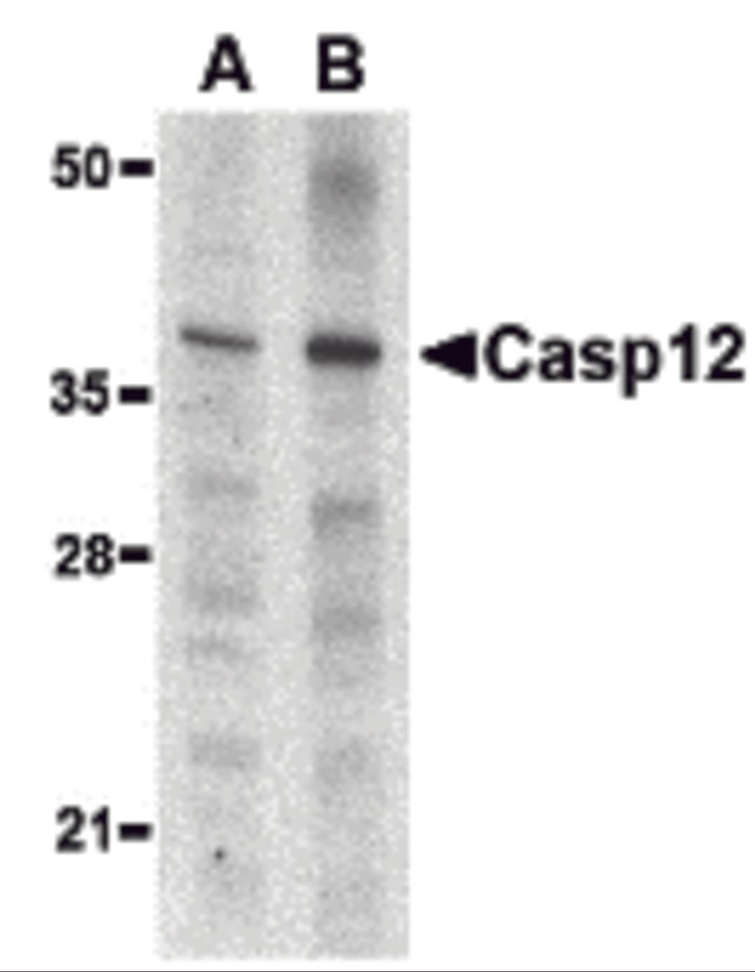 Western blot analysis of caspase-12 in mouse (lane A) and rat (lane B) liver lysate with caspase-12 antibody (small) at 1 μg/mL.