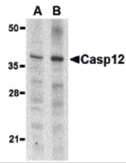 Western blot analysis of caspase-12 in mouse (lane A) and rat (lane B) liver lysate with caspase-12 antibody (small) at 1 μg/mL.