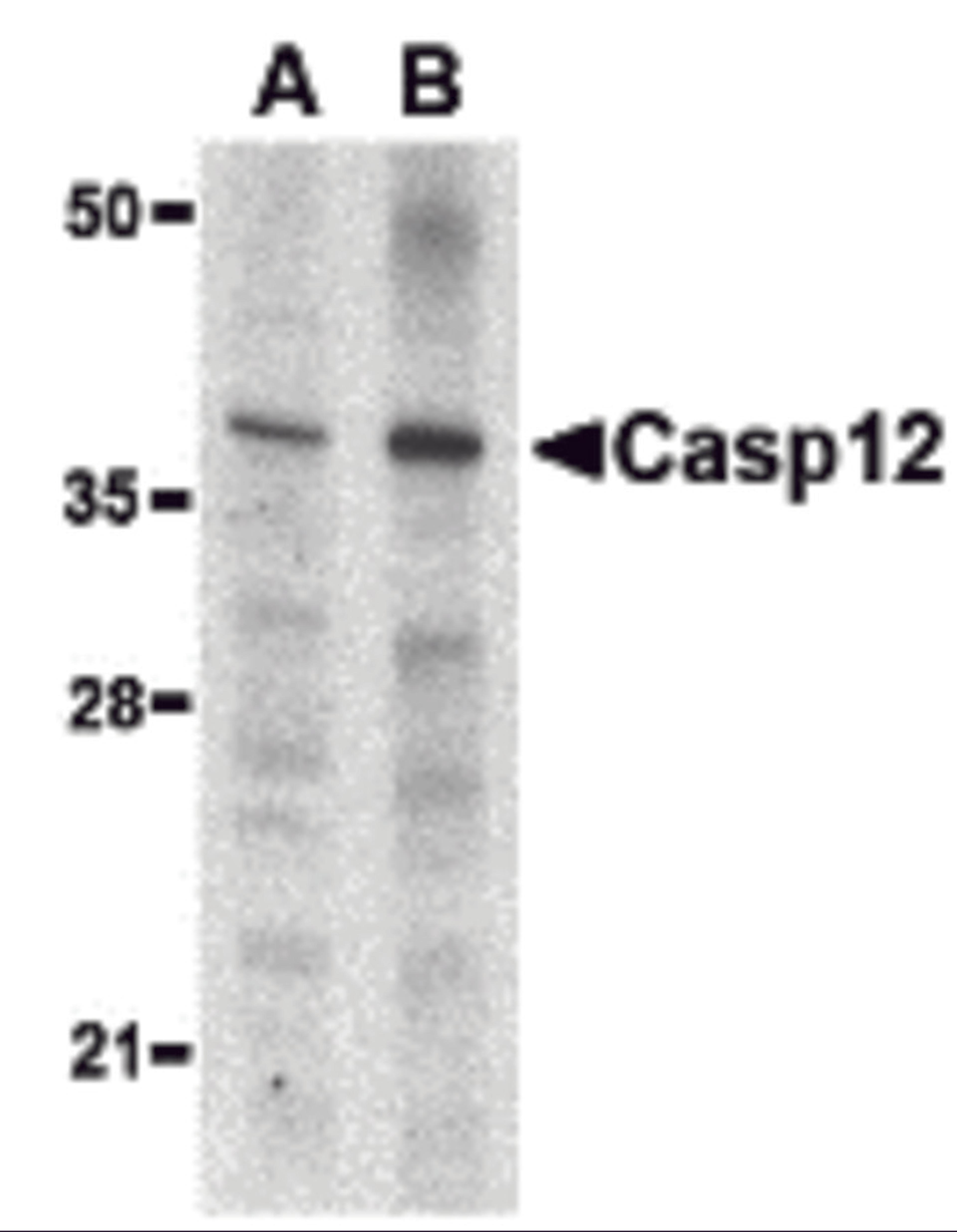 Western blot analysis of caspase-12 in mouse (lane A) and rat (lane B) liver lysate with caspase-12 antibody (small) at 1 μg/mL.