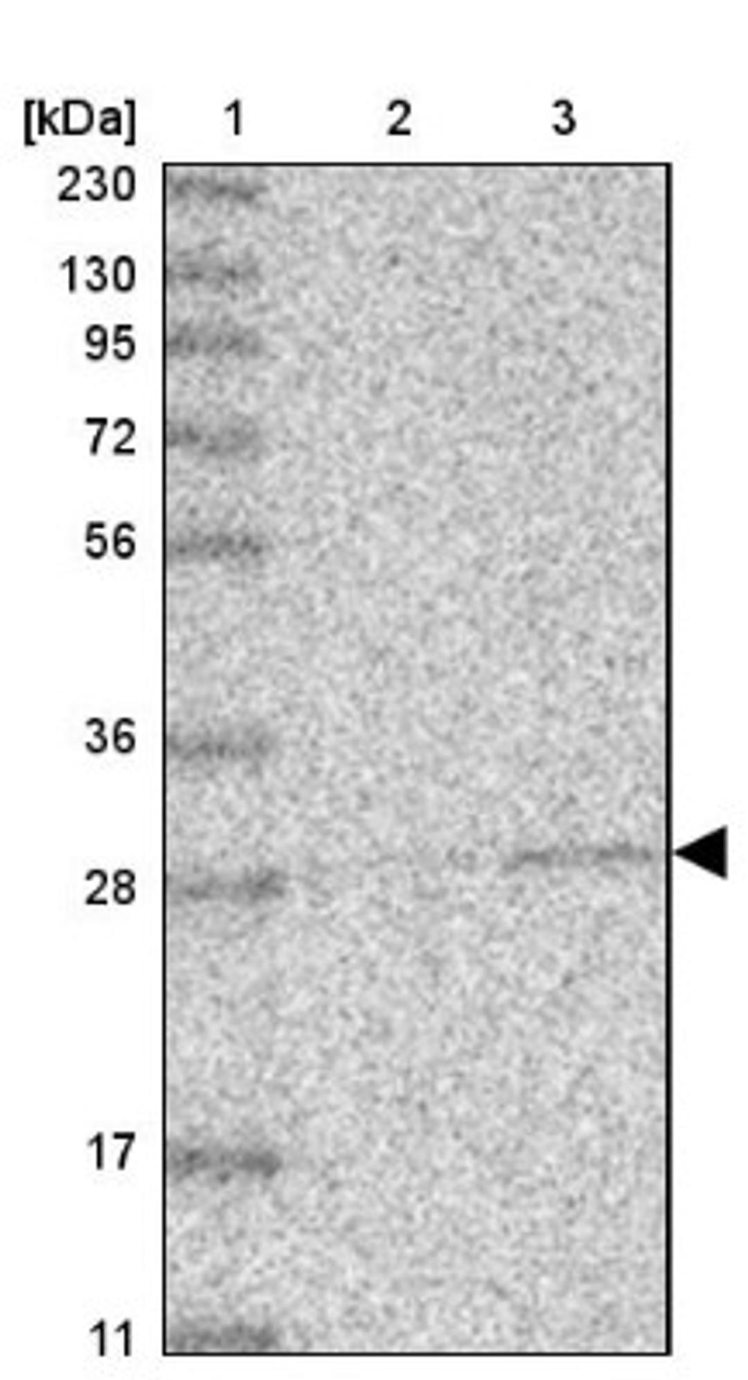 Western Blot: ABHD10 Antibody [NBP1-83748] - Lane 1: Marker [kDa] 230, 130, 95, 72, 56, 36, 28, 17, 11<br/>Lane 2: Human cell line RT-4<br/>Lane 3: Human cell line U-251MG sp