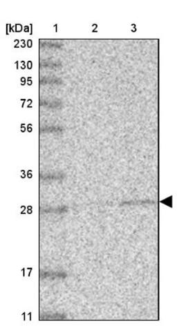 Western Blot: ABHD10 Antibody [NBP1-83748] - Lane 1: Marker [kDa] 230, 130, 95, 72, 56, 36, 28, 17, 11<br/>Lane 2: Human cell line RT-4<br/>Lane 3: Human cell line U-251MG sp