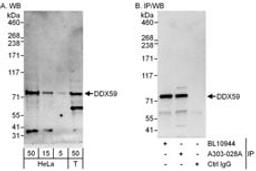 Detection of human DDX59 by western blot and immunoprecipitation.