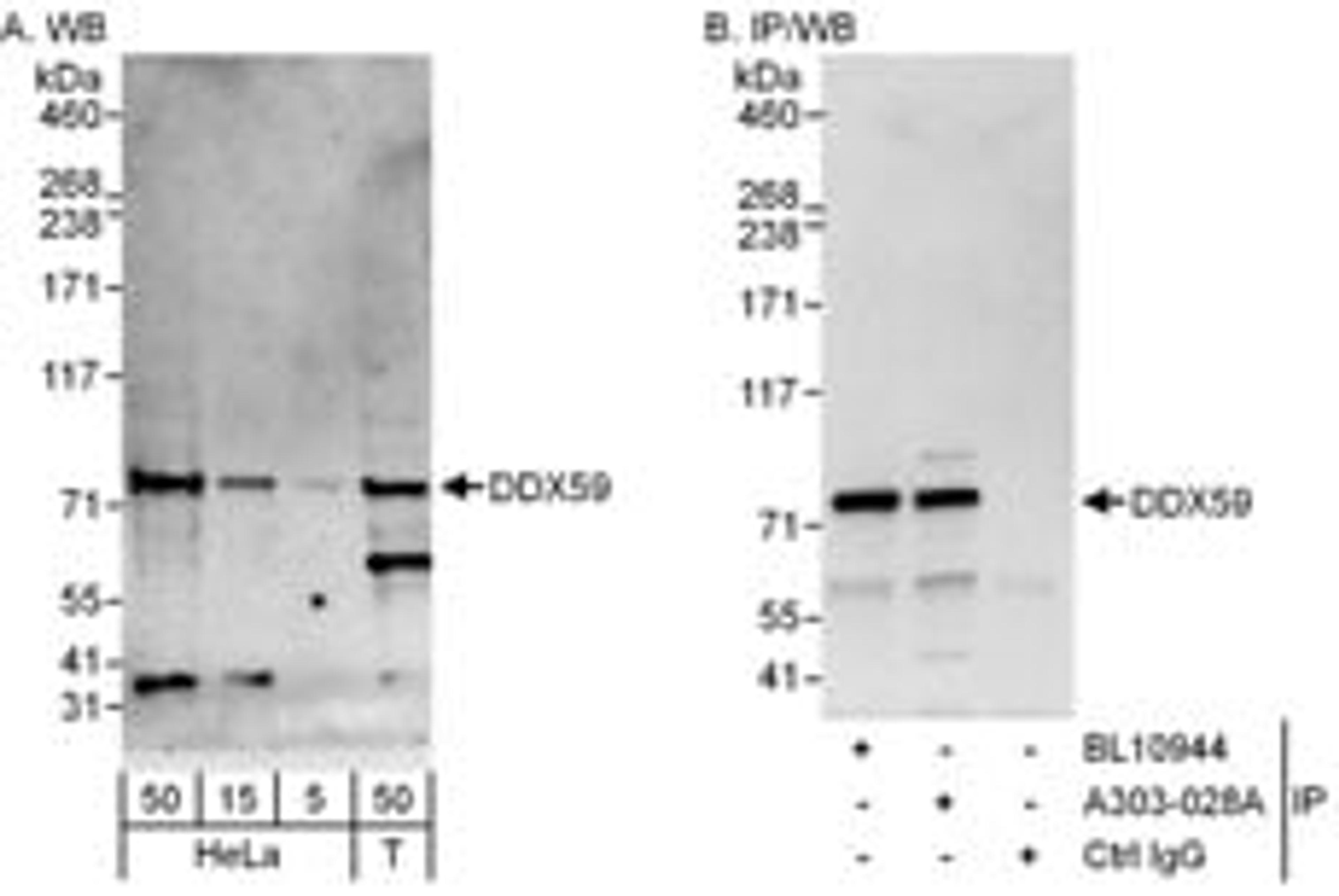 Detection of human DDX59 by western blot and immunoprecipitation.