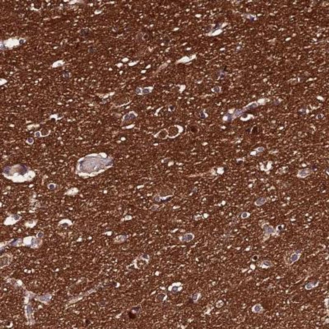 Immunohistochemistry: PPP2R2B Antibody [NBP2-46667] - Analysis  of human cerebral cortex shows distinct cytoplasmic and nuclear positivity in neuronal cells.