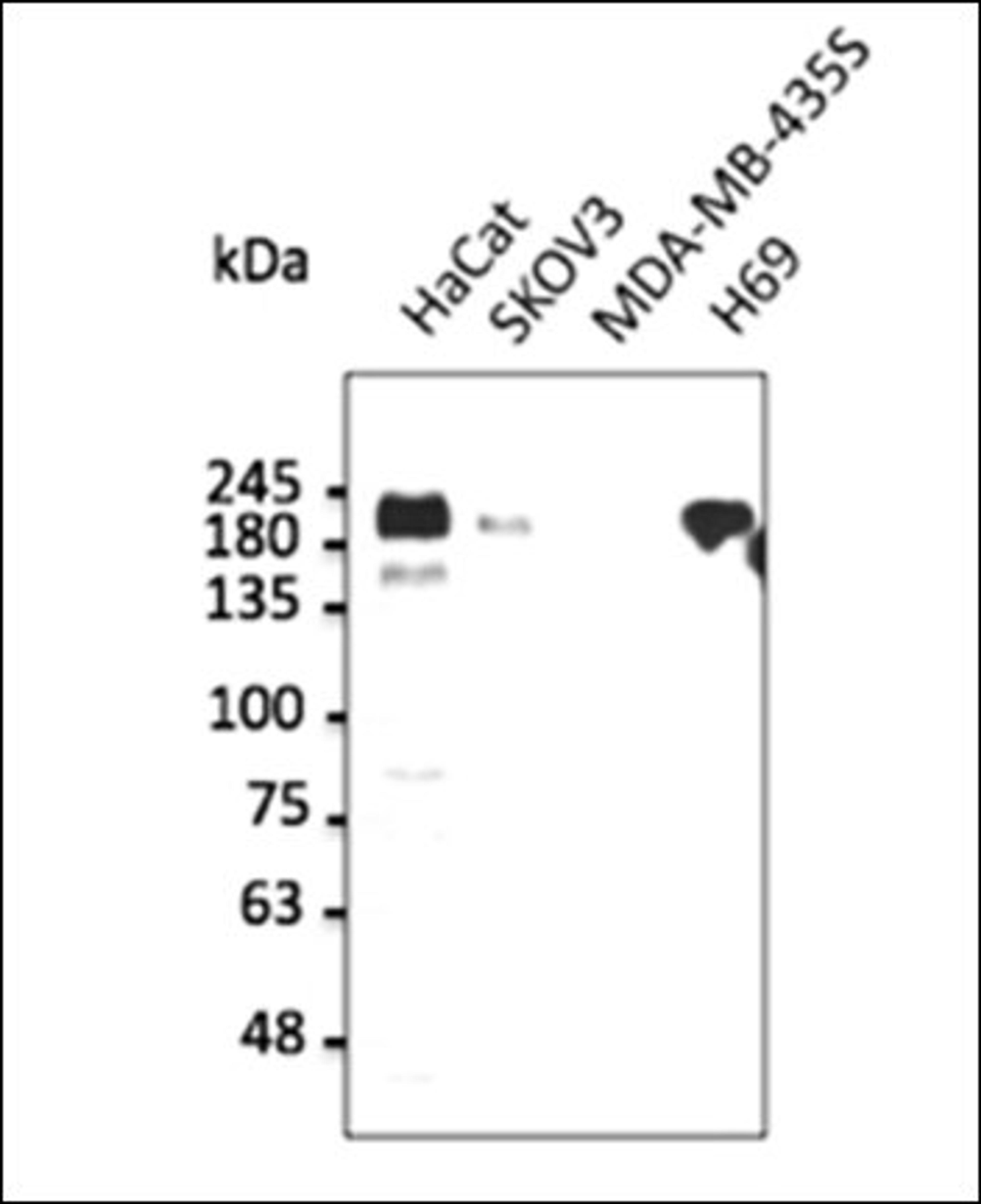 Western blot analysis of human recombinant protein using ERBB1 antibody