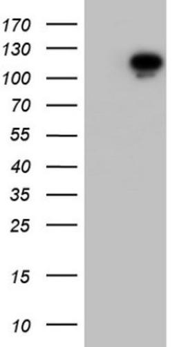 Western Blot: Filensin Antibody (2B2) [NBP2-46572] - Analysis of HEK293T cells were transfected with the pCMV6-ENTRY control (Left lane) or pCMV6-ENTRY Filensin.