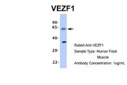 Western Blot: VEZF1 Antibody [NBP1-80115] - Human Fetal Muscle, Antibody Dilution: 1.0 ug/ml.