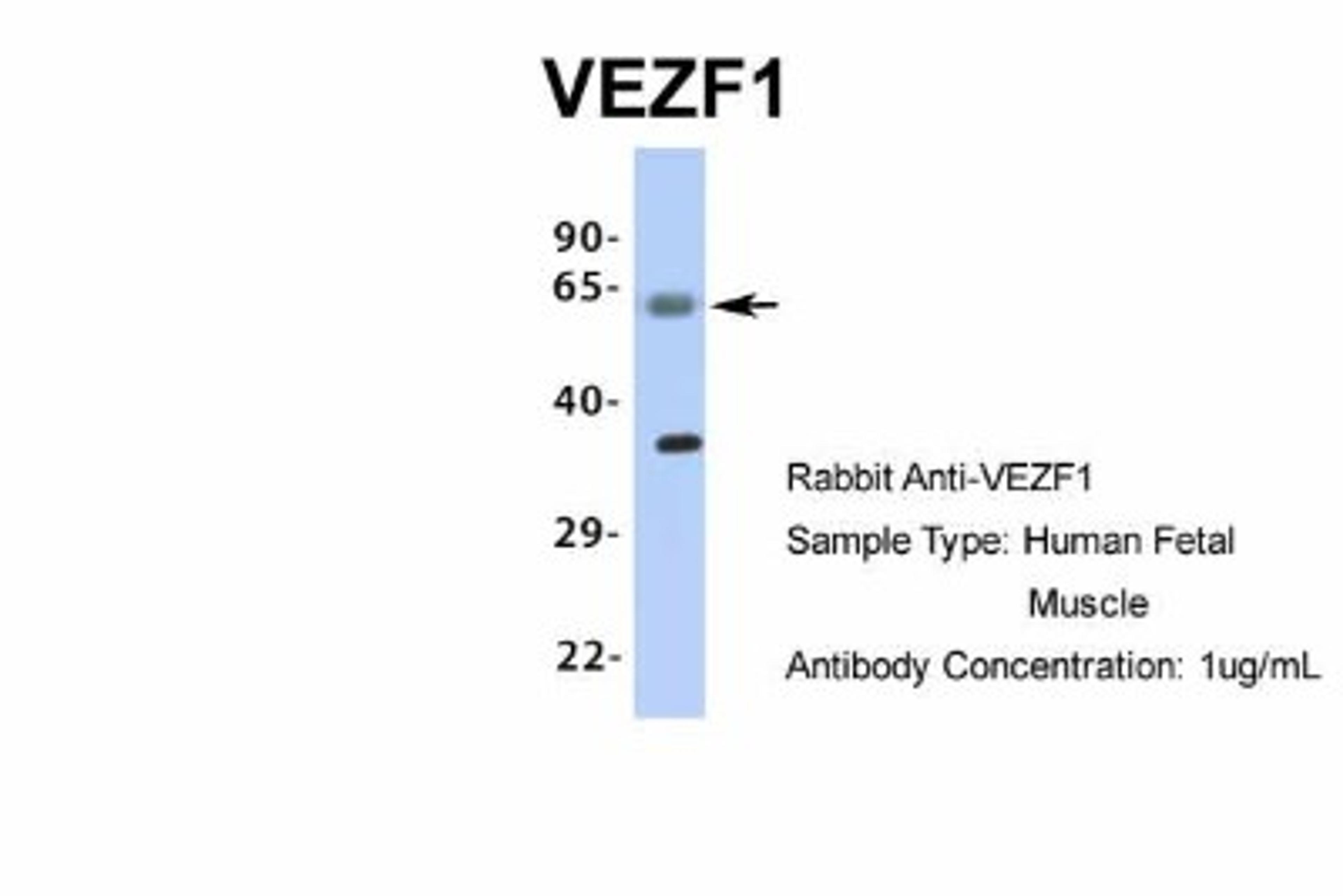 Western Blot: VEZF1 Antibody [NBP1-80115] - Human Fetal Muscle, Antibody Dilution: 1.0 ug/ml.