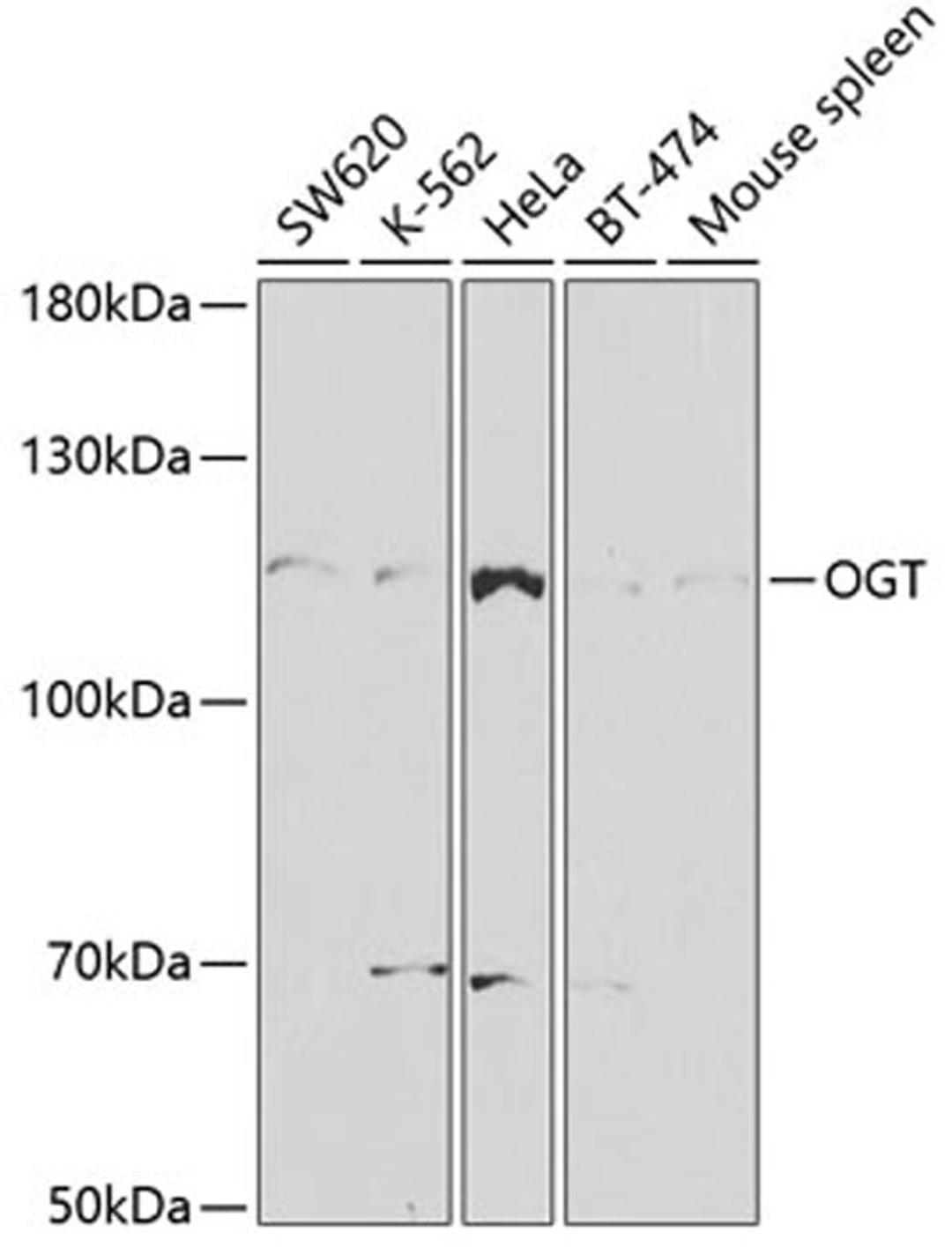 Western blot - OGT antibody (A2214)