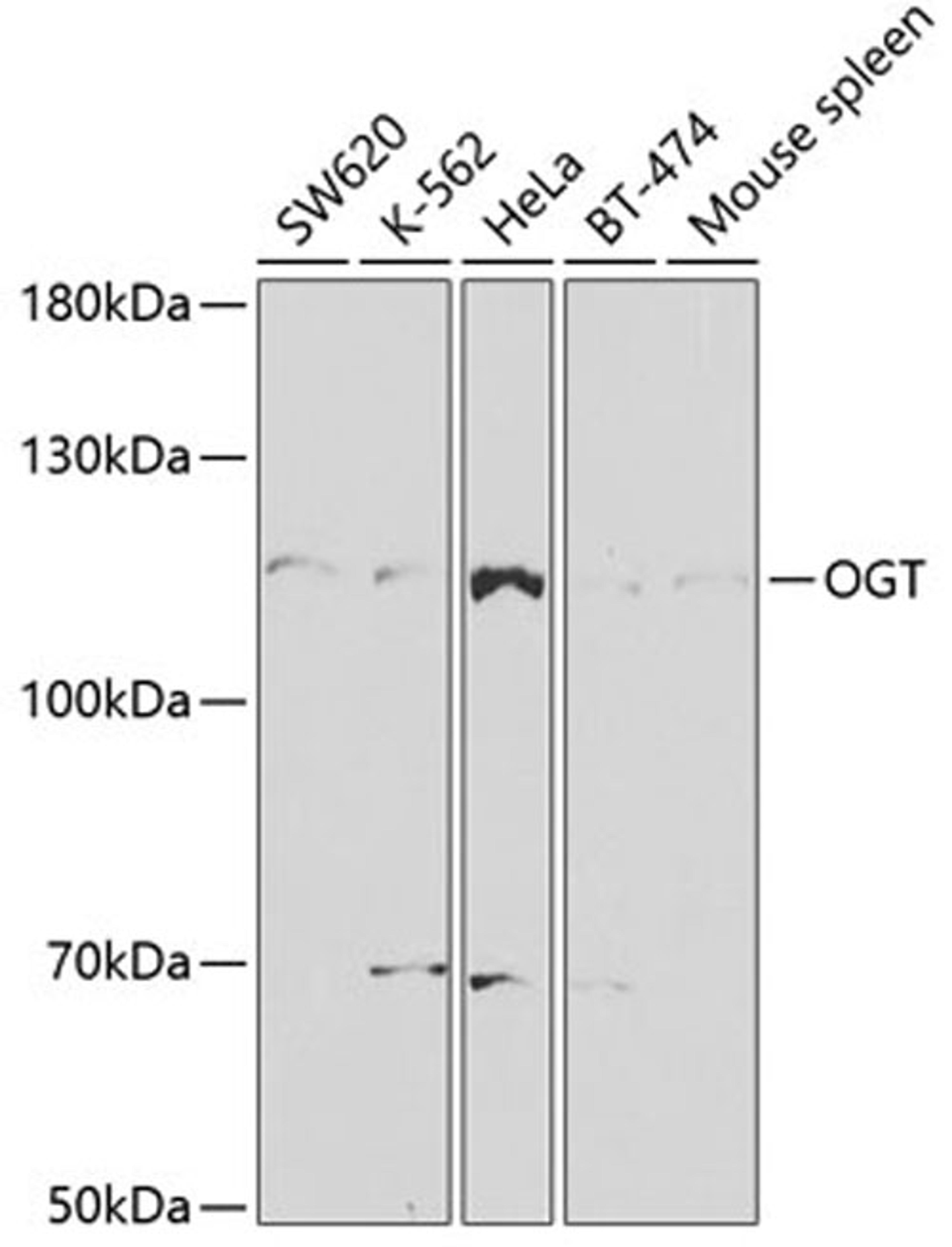 Western blot - OGT antibody (A2214)