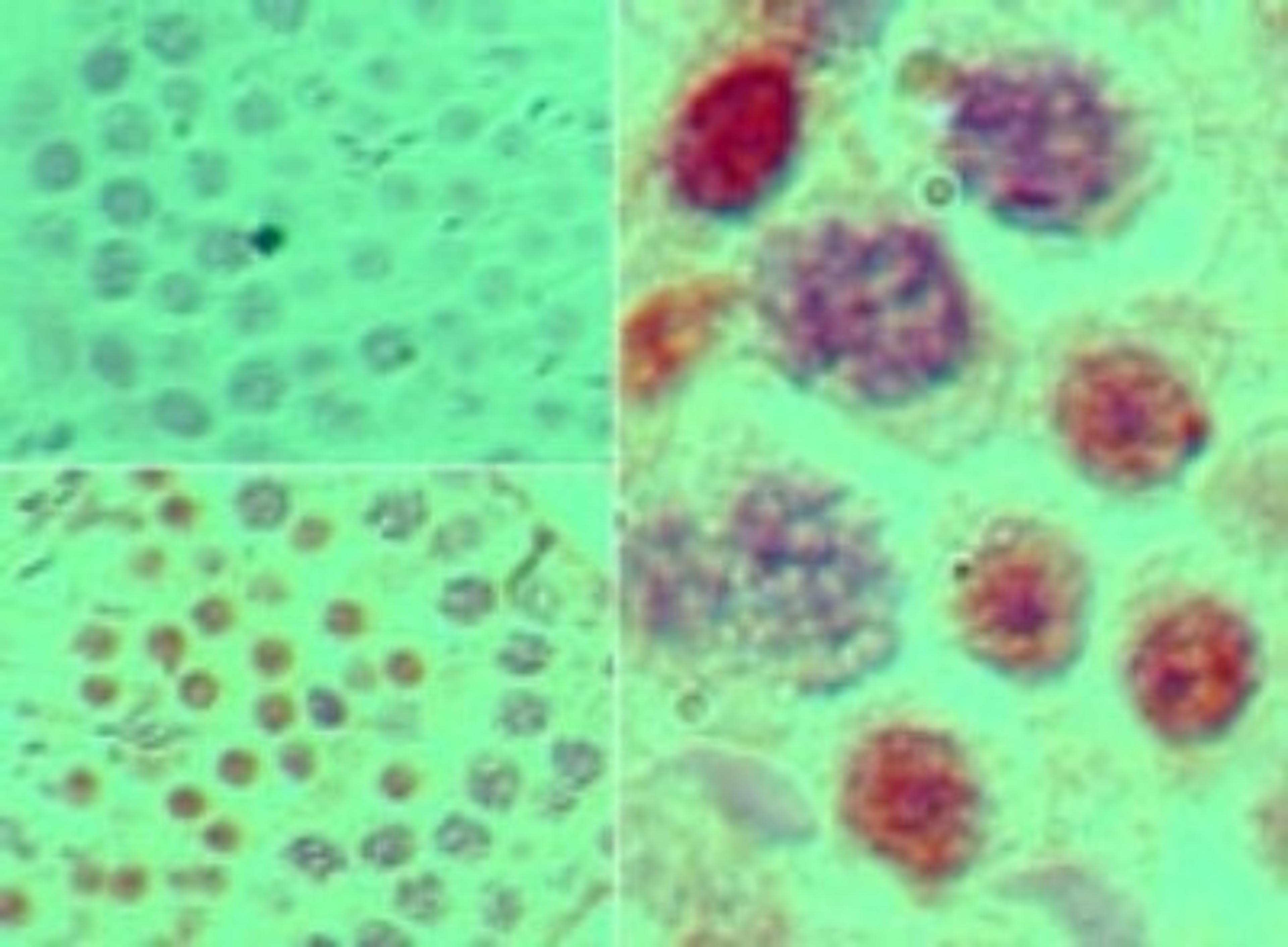 Immunohistochemistry-Paraffin: SOX9 Antibody [NBP2-24659] - Analysis of SOX9 in formalin-fixed, paraffin-embedded mouse testis tissue using an isotype control (top left) and SOX9 antibody (bottom left, right) at 5 ug/ml.