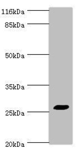 Western blot. All lanes: TREM1 antibody at 2ug/ml + HepG2 whole cell lysate. Secondary. Goat polyclonal to rabbit IgG at 1/10000 dilution. Predicted band size: 27, 18, 26 kDa. Observed band size: 27 kDa.