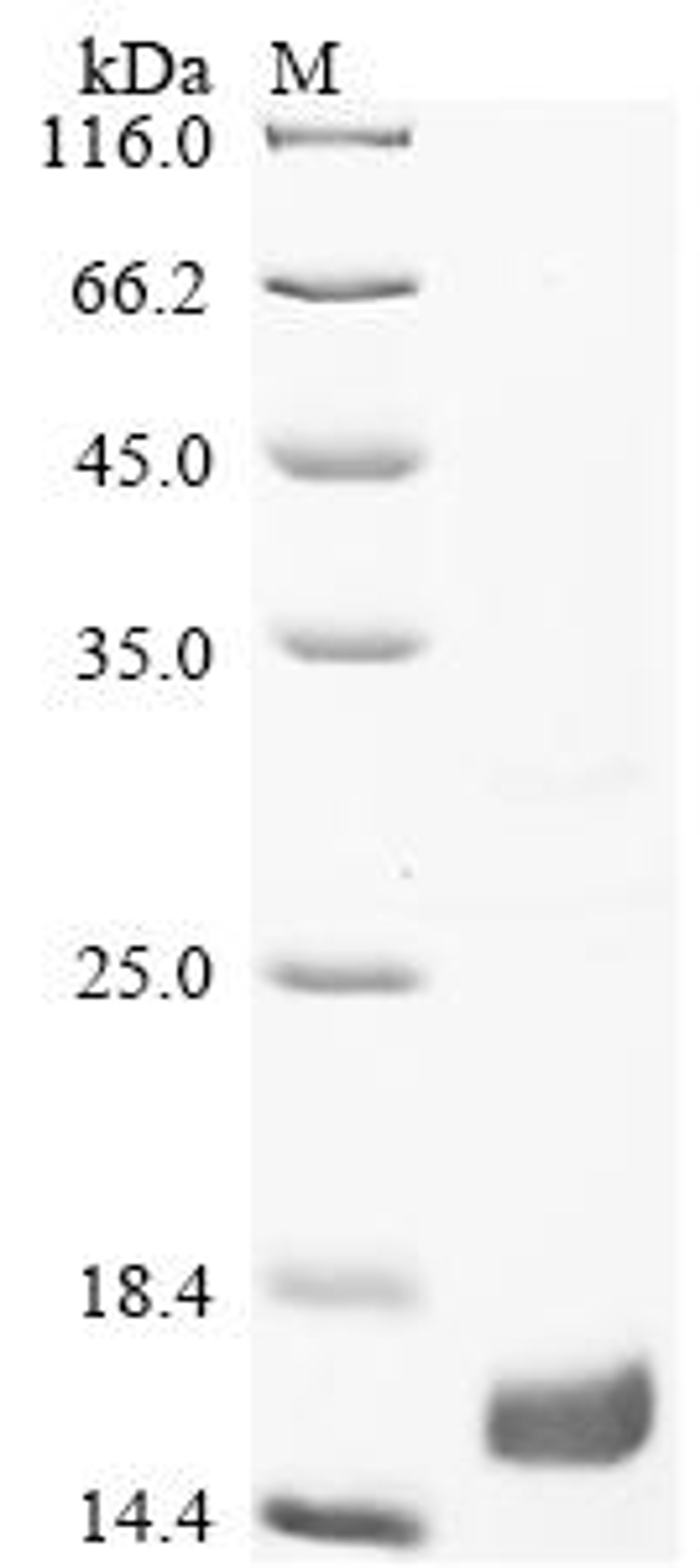 (Tris-Glycine gel) Discontinuous SDS-PAGE (reduced) with 5% enrichment gel and 15% separation gel.