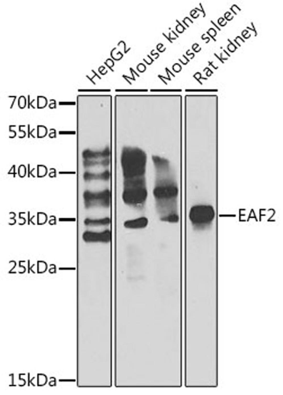 Western blot - EAF2 antibody (A7119)