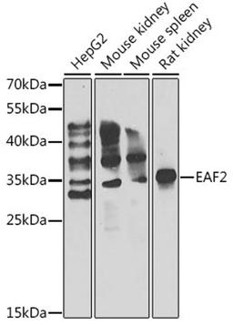 Western blot - EAF2 antibody (A7119)