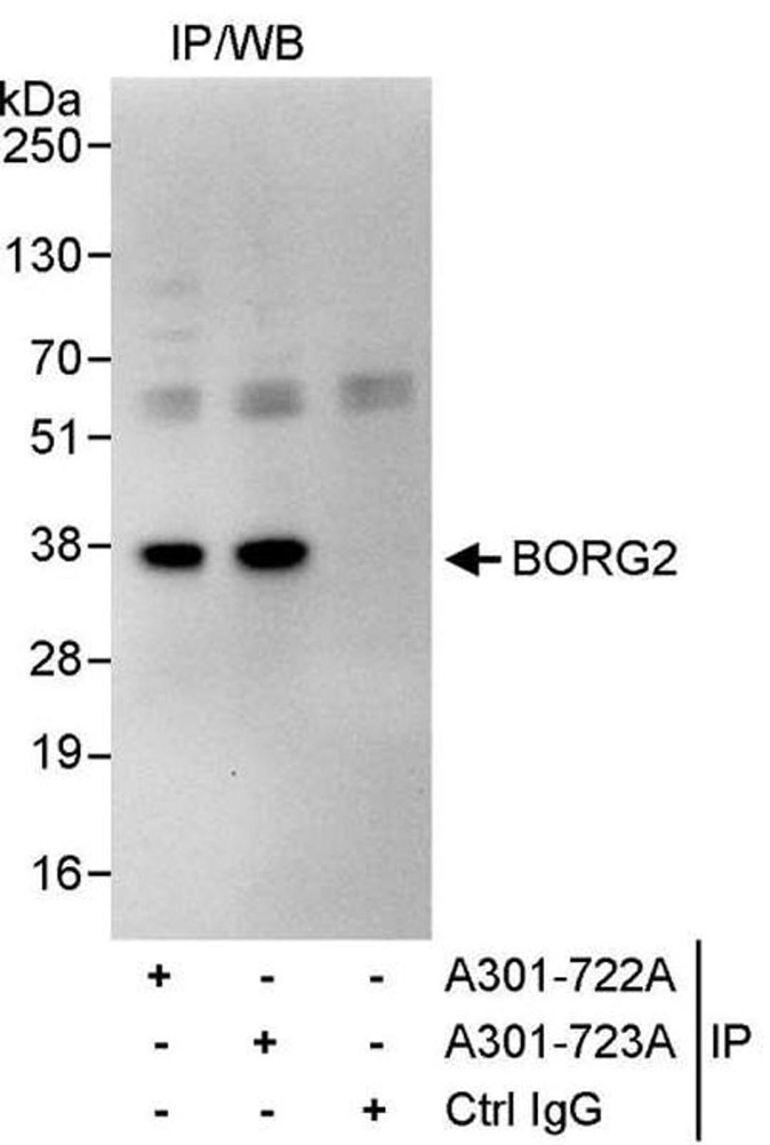 Detection of human BORG2 by WB of IP.