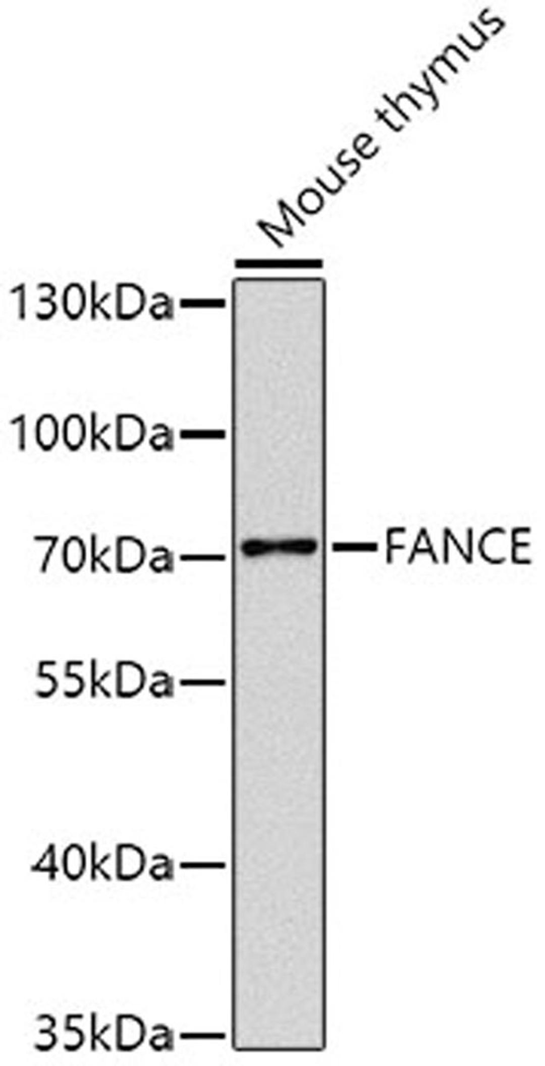 Western blot - FANCE antibody (A8417)