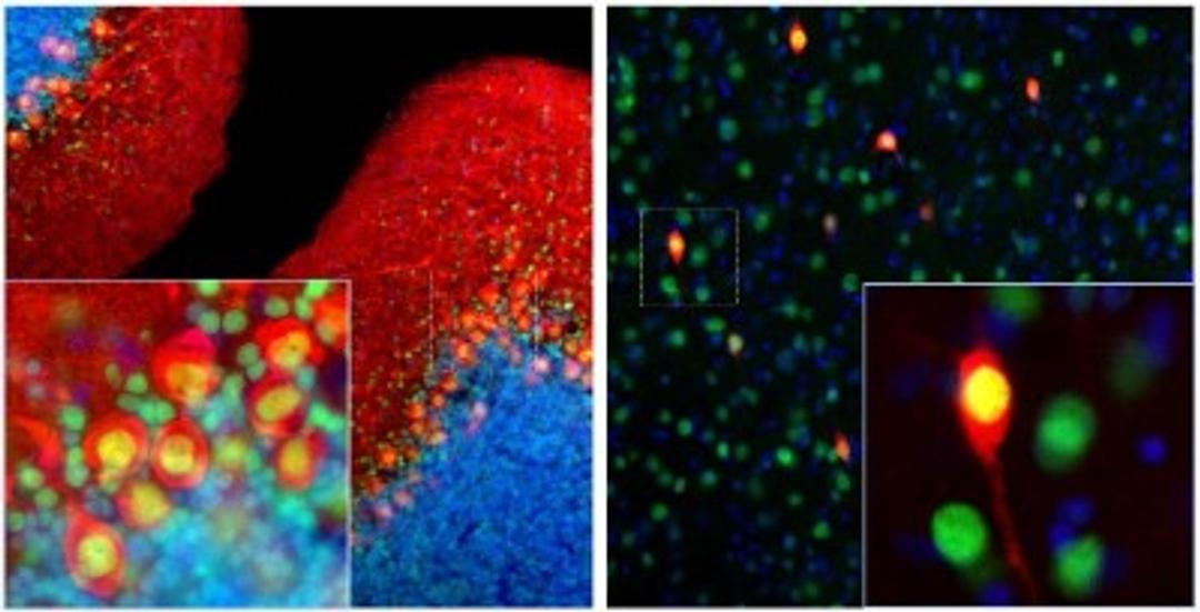 Immunocytochemistry/Immunofluorescence: Calbindin D-28K Antibody (4H7) [NBP2-50048] - Rat brain cerebellum (Middle) and cortex (Right) sections (45 uM; fixed by transcardial perfusion with 4% paraformaldehyde) were co-stained with NBP2-50048 (red) and anti-MeCP2 rabbit antibody (NBP2-50060, green). Calbindin is predominantly expressed in the dendrites and perikarya of Purkinje cells in the molecular layer of cerebellum, and selectively expressed in certain type of interneurons (calbindin-postive interneuron) in the cortex. MeCP2 is universally expressed in the nuclei of almost all neurons. As a result, calbindin-expressing cell is strongly labeled with red in soma, but the nucleus appears to be yellow. Blue is Dapi nucleus staining. Insets are high magnification images of the boxed areas.