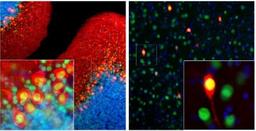 Immunocytochemistry/Immunofluorescence: Calbindin D-28K Antibody (4H7) [NBP2-50048] - Rat brain cerebellum (Middle) and cortex (Right) sections (45 uM; fixed by transcardial perfusion with 4% paraformaldehyde) were co-stained with NBP2-50048 (red) and anti-MeCP2 rabbit antibody (NBP2-50060, green). Calbindin is predominantly expressed in the dendrites and perikarya of Purkinje cells in the molecular layer of cerebellum, and selectively expressed in certain type of interneurons (calbindin-postive interneuron) in the cortex. MeCP2 is universally expressed in the nuclei of almost all neurons. As a result, calbindin-expressing cell is strongly labeled with red in soma, but the nucleus appears to be yellow. Blue is Dapi nucleus staining. Insets are high magnification images of the boxed areas.