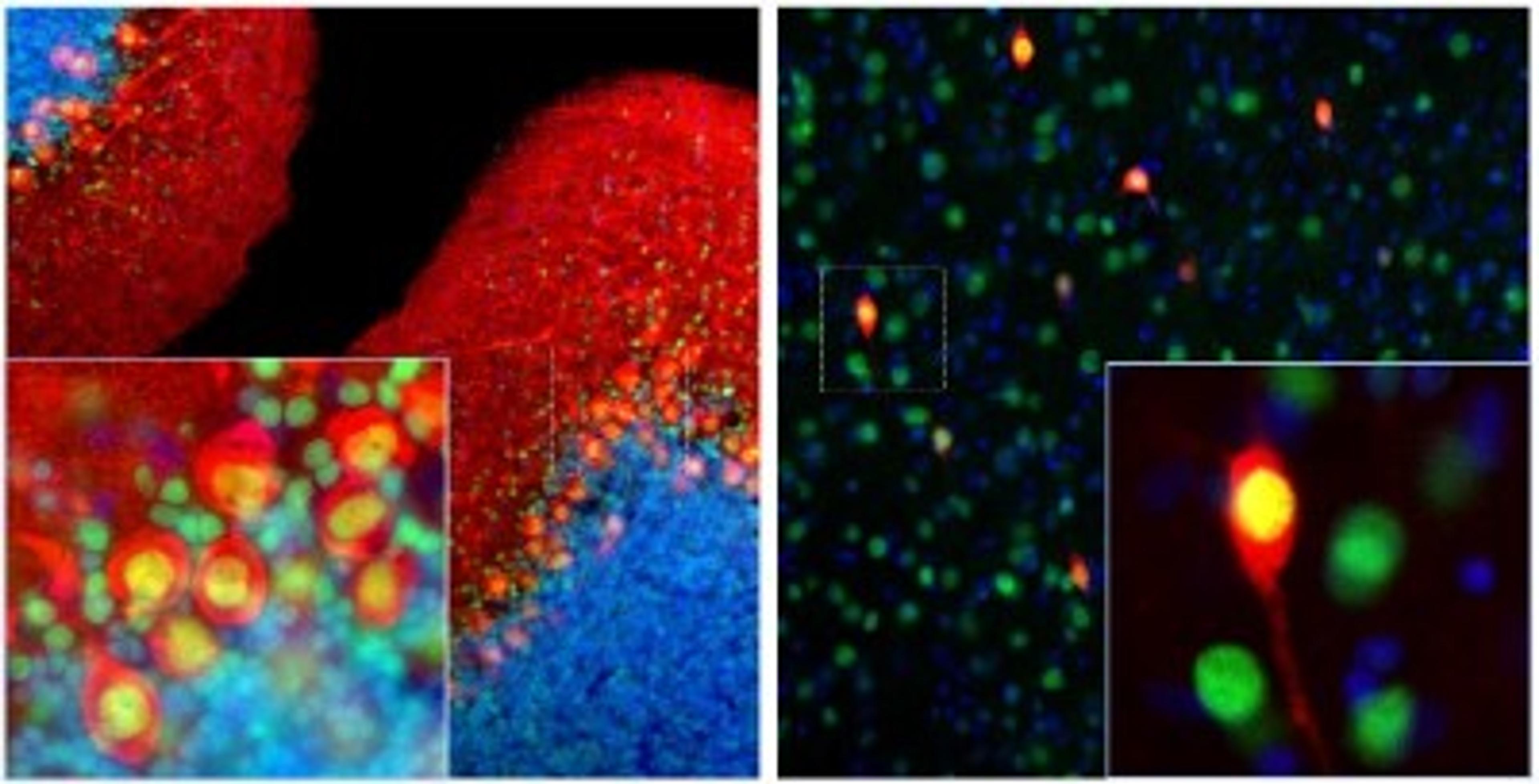 Immunocytochemistry/Immunofluorescence: Calbindin D-28K Antibody (4H7) [NBP2-50048] - Rat brain cerebellum (Middle) and cortex (Right) sections (45 uM; fixed by transcardial perfusion with 4% paraformaldehyde) were co-stained with NBP2-50048 (red) and anti-MeCP2 rabbit antibody (NBP2-50060, green). Calbindin is predominantly expressed in the dendrites and perikarya of Purkinje cells in the molecular layer of cerebellum, and selectively expressed in certain type of interneurons (calbindin-postive interneuron) in the cortex. MeCP2 is universally expressed in the nuclei of almost all neurons. As a result, calbindin-expressing cell is strongly labeled with red in soma, but the nucleus appears to be yellow. Blue is Dapi nucleus staining. Insets are high magnification images of the boxed areas.