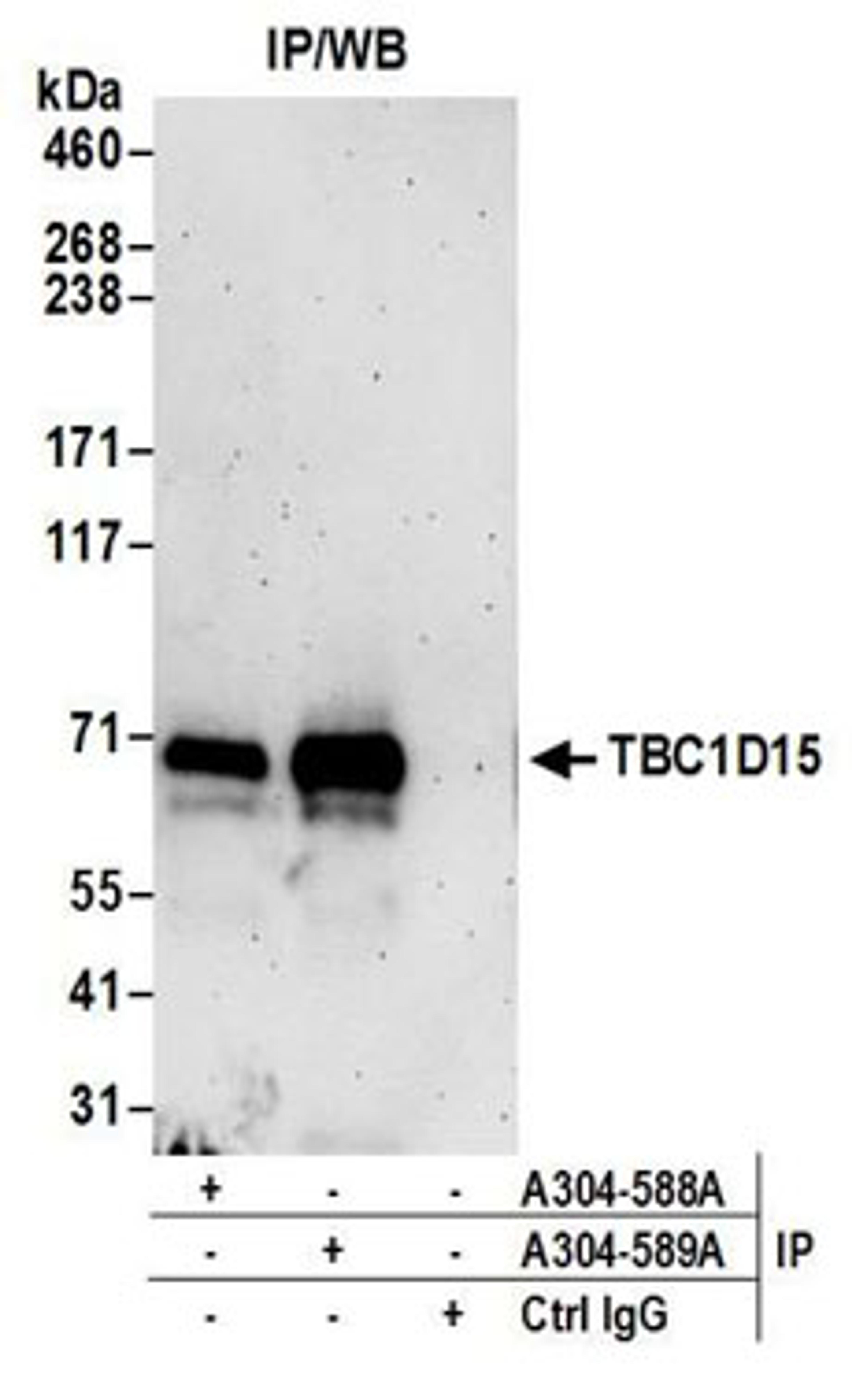 Detection of human TBC1D15 by western blot of immunoprecipitates.