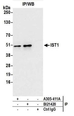 Detection of human IST1 by western blot of immunoprecipitates.