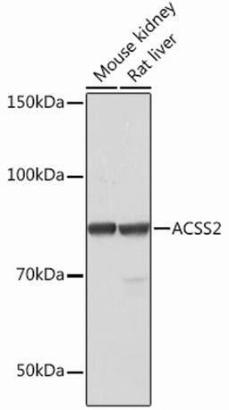 Western blot - ACSS2 Rabbit mAb (A12334)