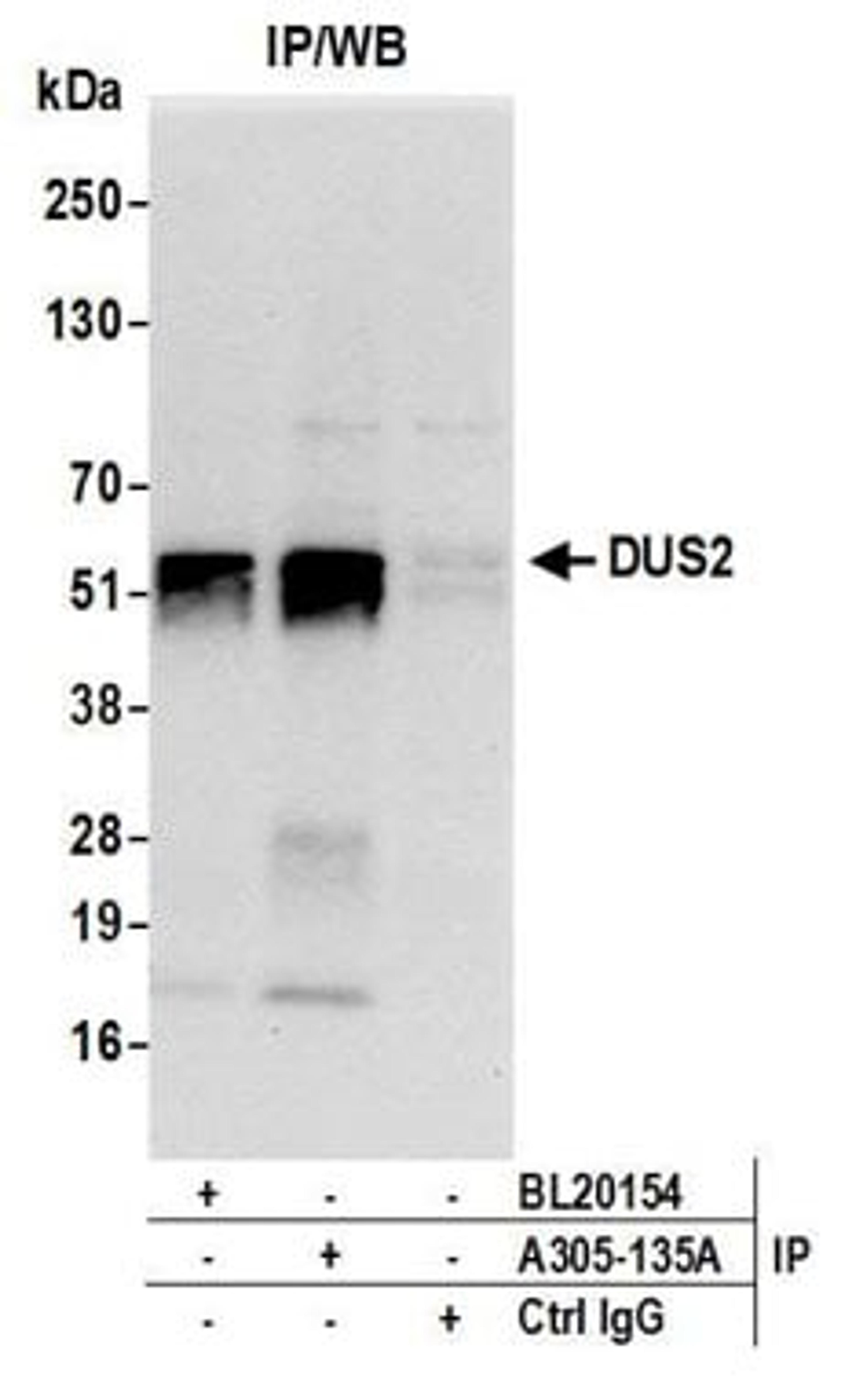 Detection of human DUS2 by western blot of immunoprecipitates.