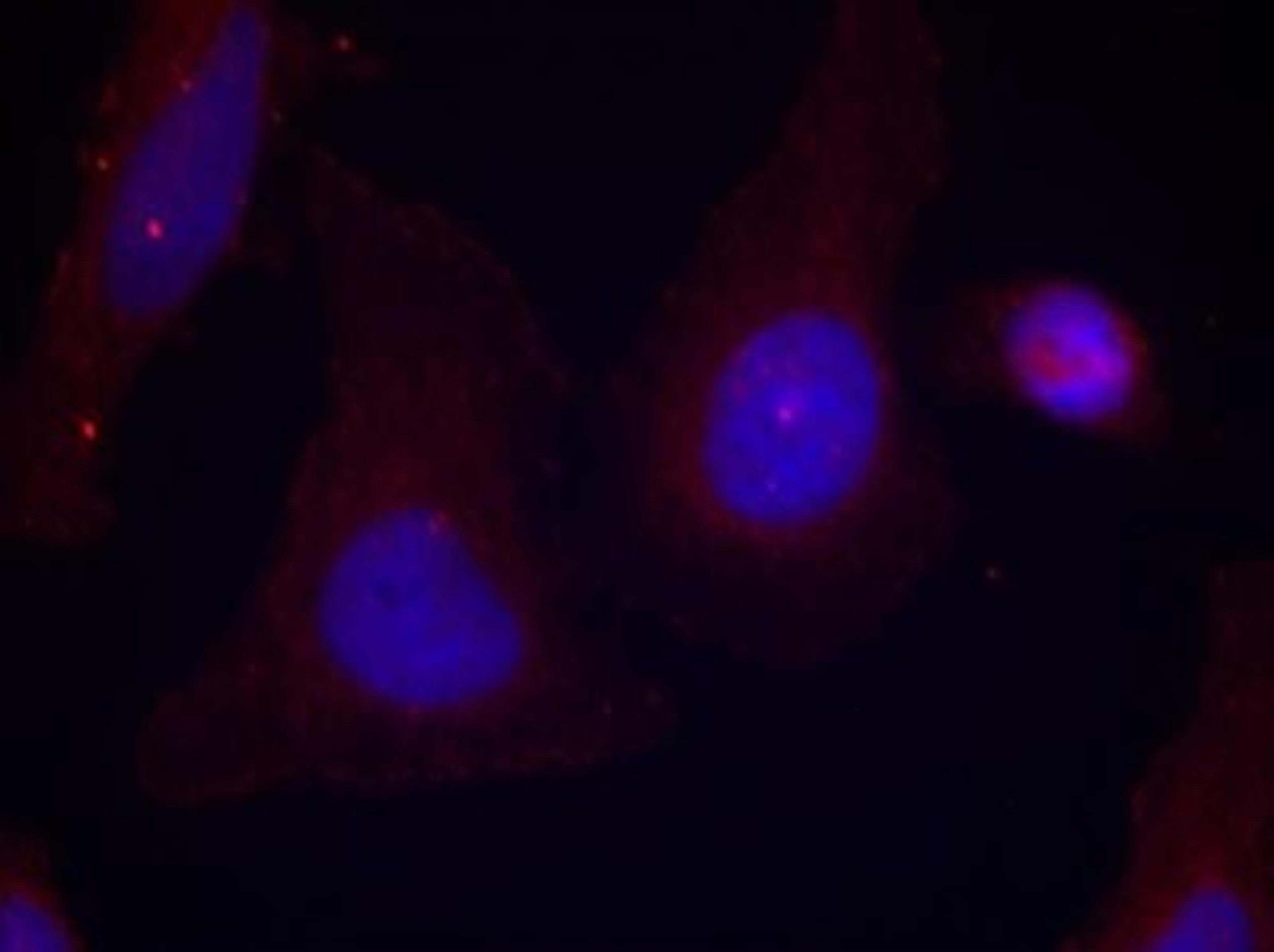 Immunocytochemistry/Immunofluorescence: PYK2 [p Tyr402] Antibody [NB100-82168] - Staining of methanol-fixed Hela cells using Pyk2 (Phospho-Tyr402) antibody