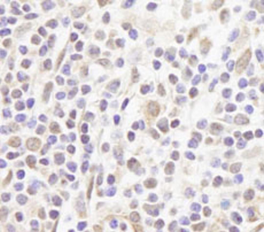 Detection of human FOG1/ZFPM1 by immunohistochemistry.