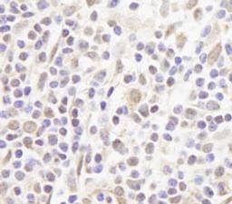 Detection of human FOG1/ZFPM1 by immunohistochemistry.