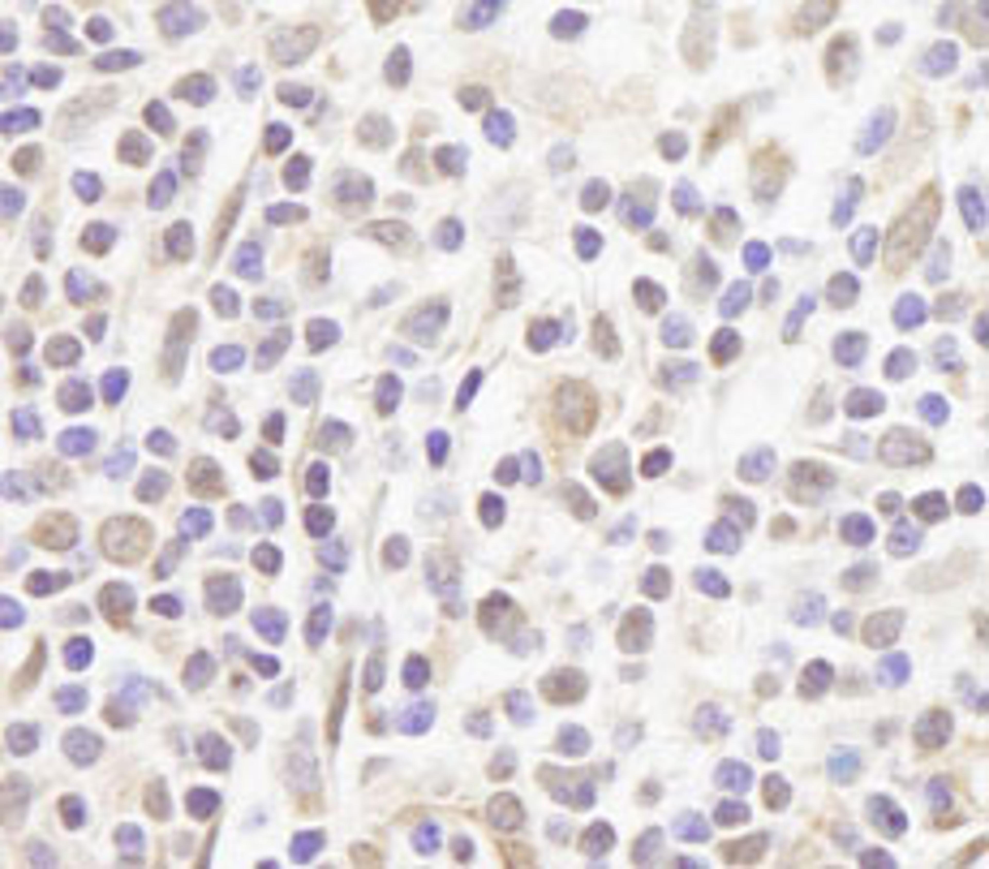 Detection of human FOG1/ZFPM1 by immunohistochemistry.