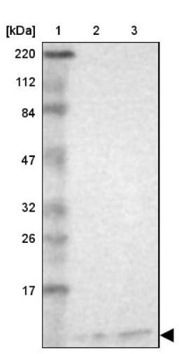 Western Blot: RPS21 Antibody [NBP1-87100] - Lane 1: Marker [kDa] 220, 112, 84, 47, 32, 26, 17<br/>Lane 2: Human cell line RT-4<br/>Lane 3: Human cell line U-251MG sp