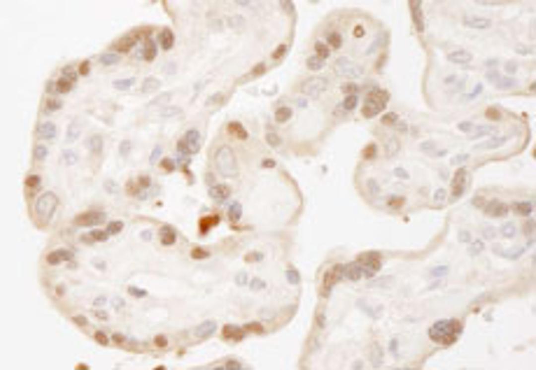 Detection of human MST1,2/STK3,4 by immunohistochemistry.