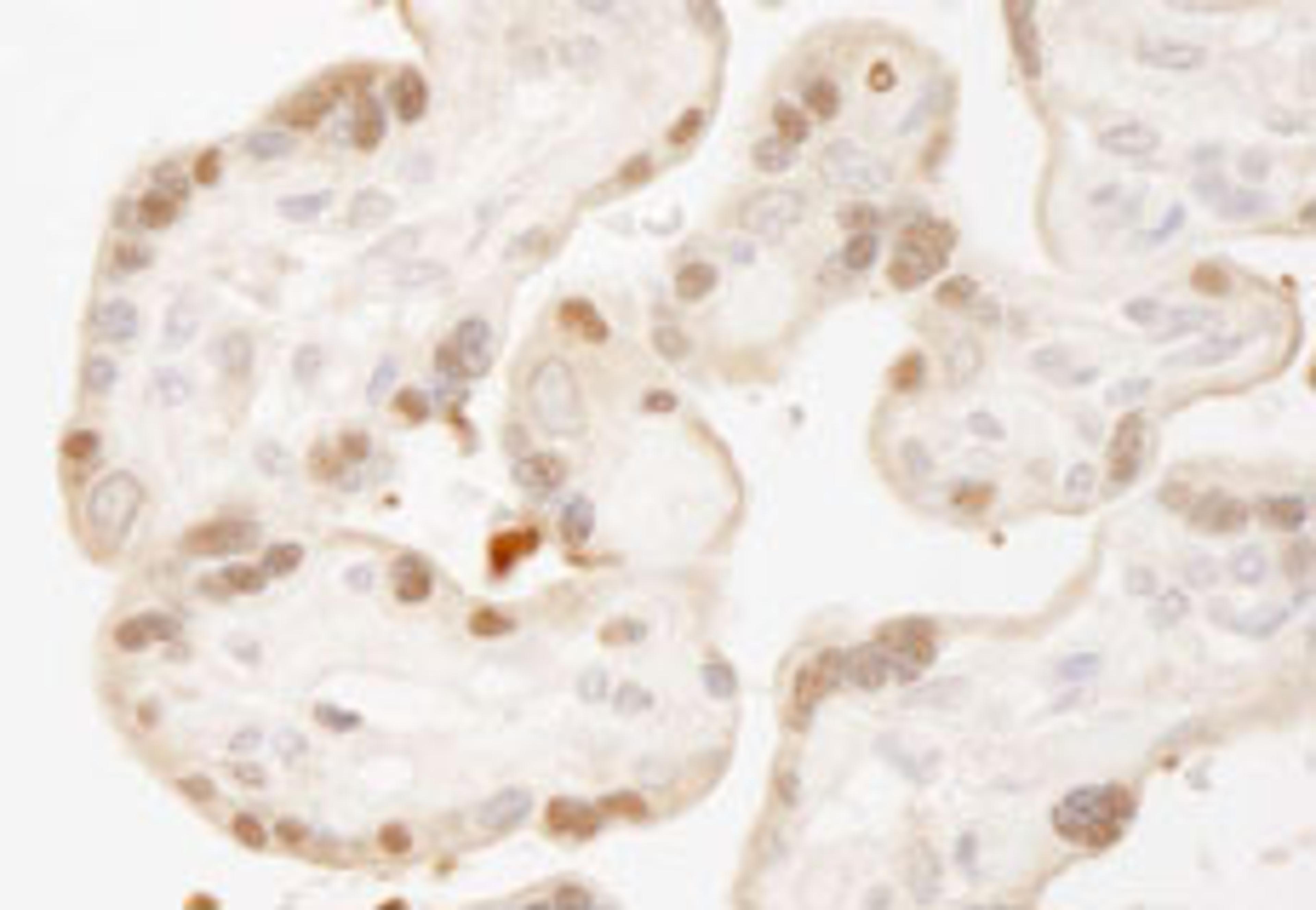 Detection of human MST1,2/STK3,4 by immunohistochemistry.