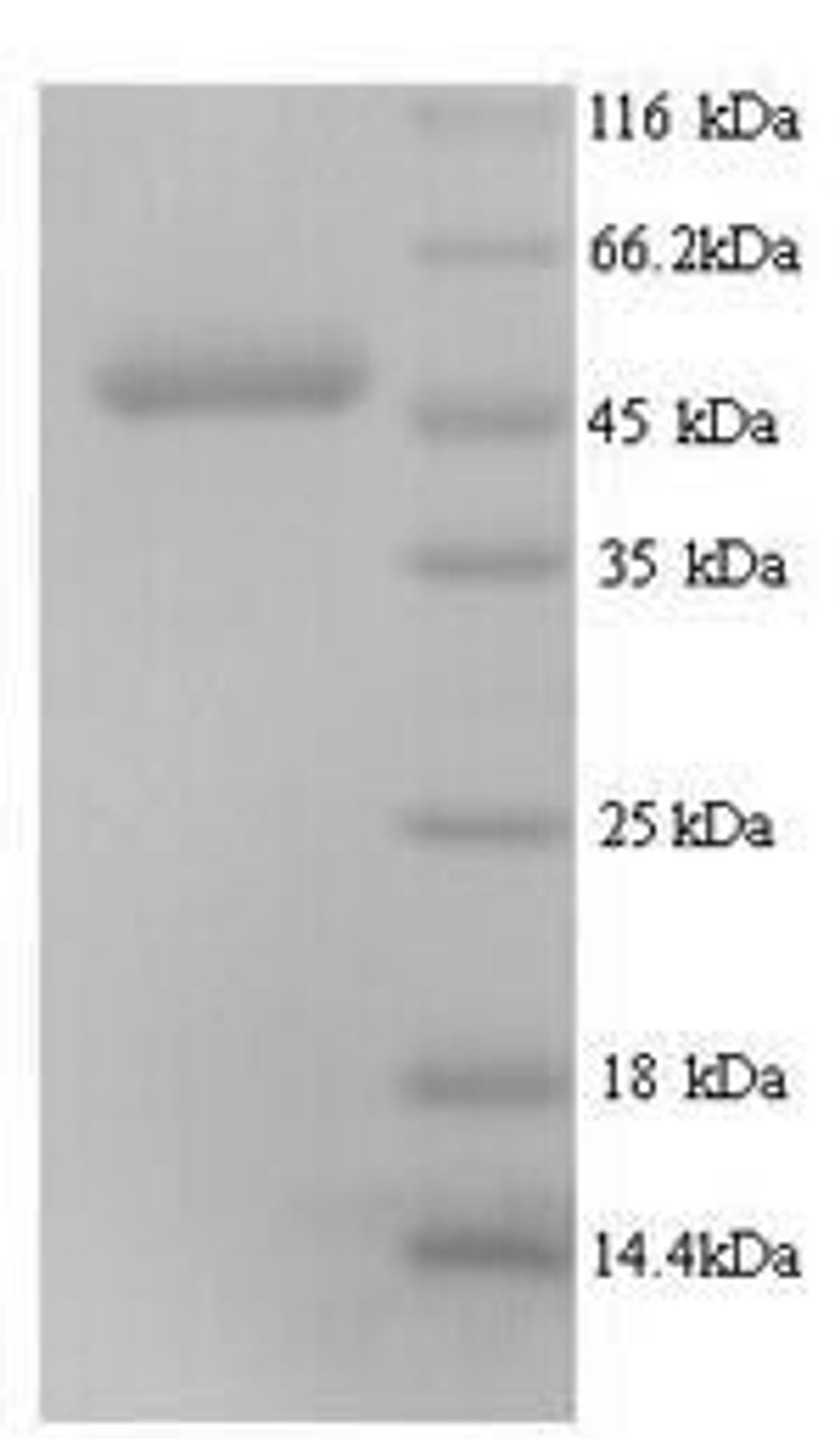 (Tris-Glycine gel) Discontinuous SDS-PAGE (reduced) with 5% enrichment gel and 15% separation gel.
