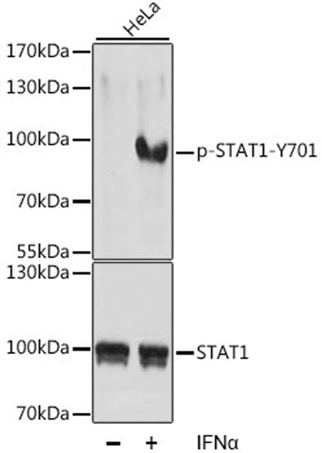 Western blot - Phospho-STAT1-Y701 antibody (AP0135)