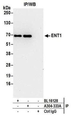 Detection of human ENT1 by western blot of immunoprecipitates.