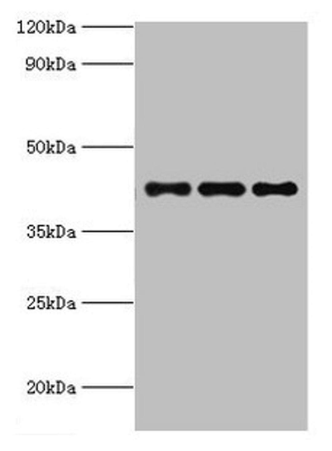 Western blot. All lanes: RRM2B antibody at 3ug/ml. Lane 1: MCF-7 whole cell lysate. Lane 2: Hela whole cell lysate. Lane 3: HepG2 whole cell lysate. Secondary. Goat polyclonal to rabbit IgG at 1/10000 dilution. Predicted band size: 41, 35, 16, 8, 5, 49 kDa. Observed band size: 41 kDa.