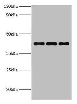 Western blot. All lanes: RRM2B antibody at 3ug/ml. Lane 1: MCF-7 whole cell lysate. Lane 2: Hela whole cell lysate. Lane 3: HepG2 whole cell lysate. Secondary. Goat polyclonal to rabbit IgG at 1/10000 dilution. Predicted band size: 41, 35, 16, 8, 5, 49 kDa. Observed band size: 41 kDa.