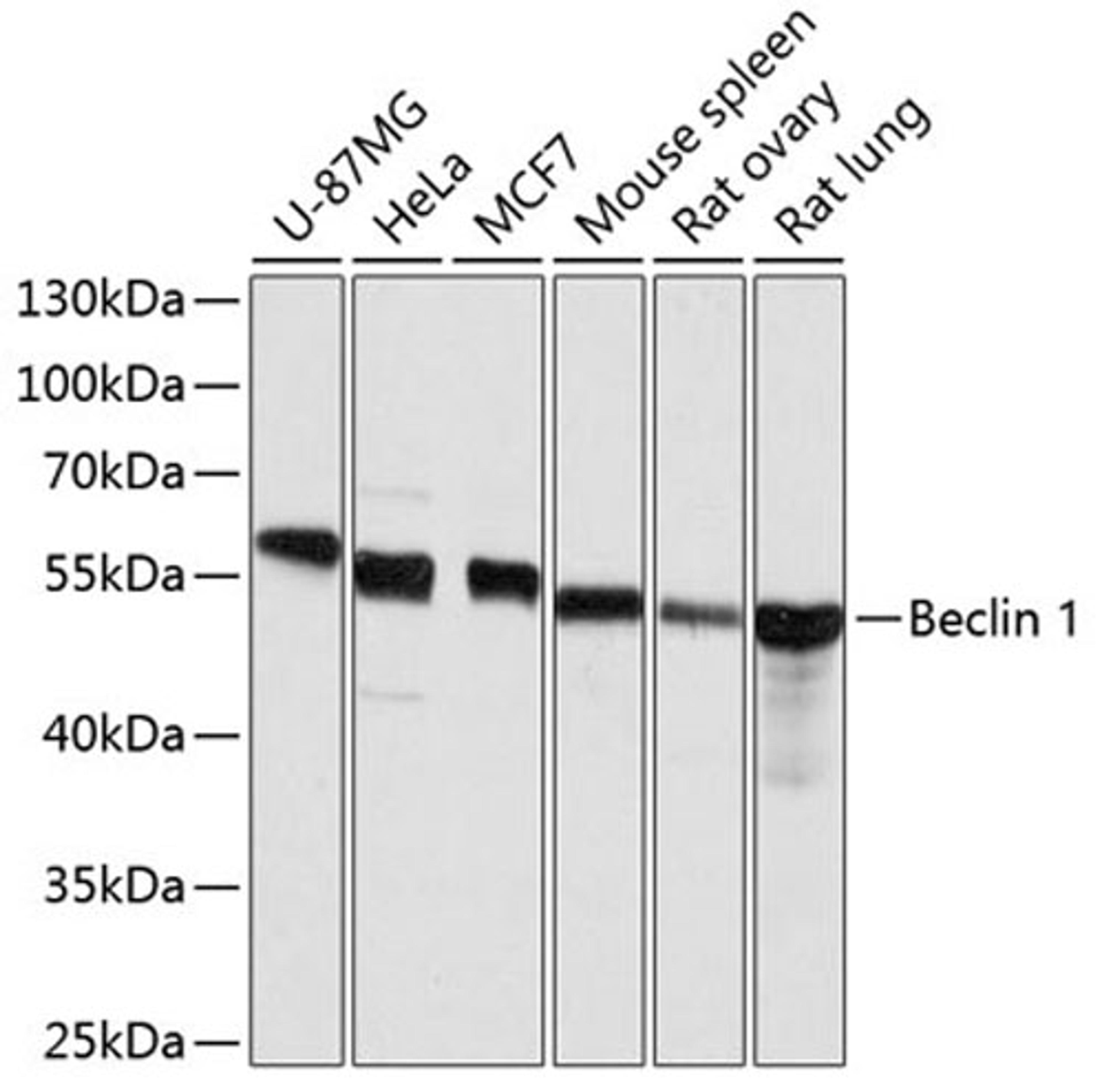 Western blot - Beclin 1 antibody (A11761)