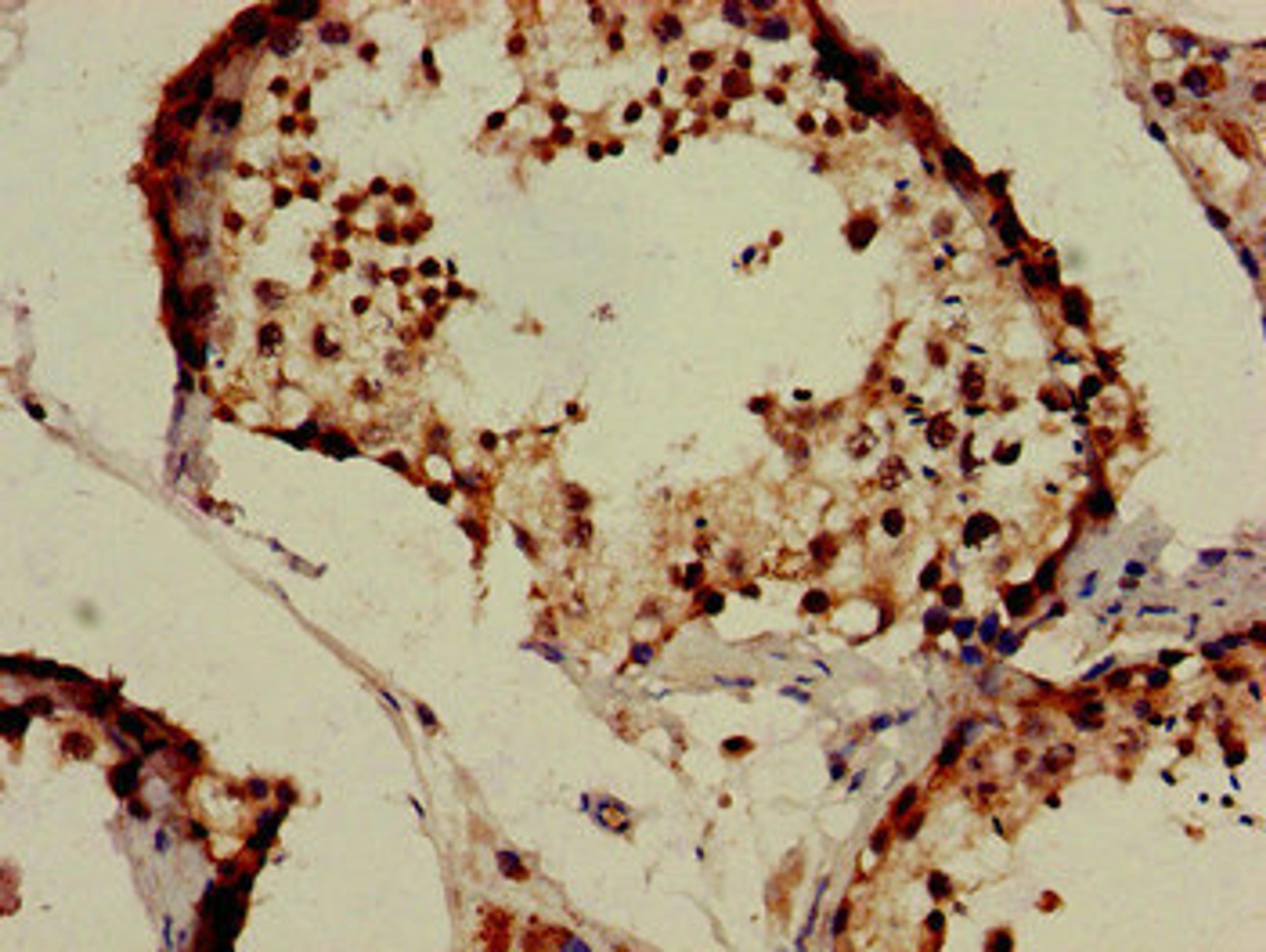 Immunohistochemistry of paraffin-embedded human testis tissue using CSB-PA812903LA01HU at dilution of 1:100