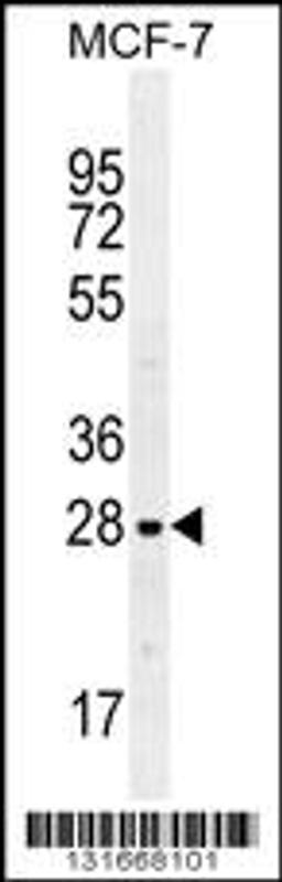 Western blot analysis in MCF-7 cell line lysates (35ug/lane).